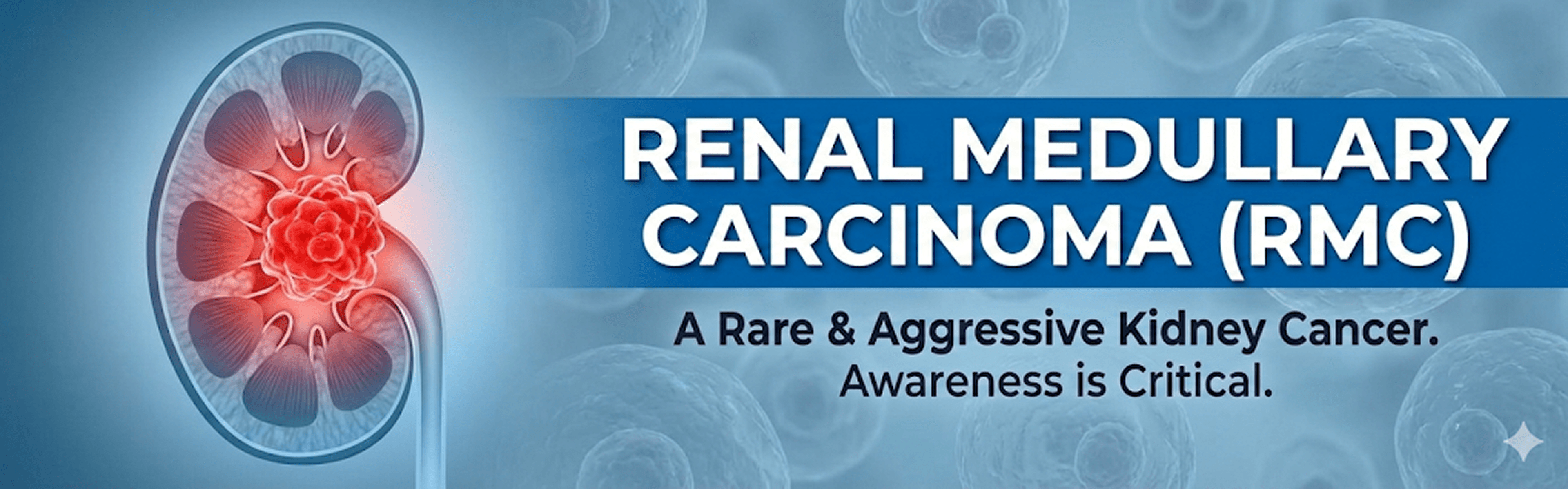 Renal Medullary Carcinoma
